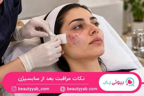 نکات مراقبت بعد از سابسیژن