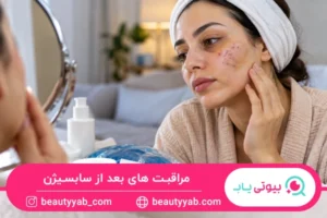 مراقبت های بعد از سابسیژن